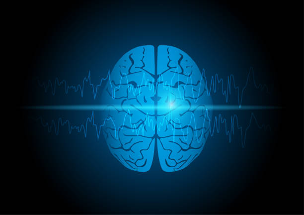 Illustration of human brain with focal seizure showing abnormal sharp wave on electroencephalography or EEG.