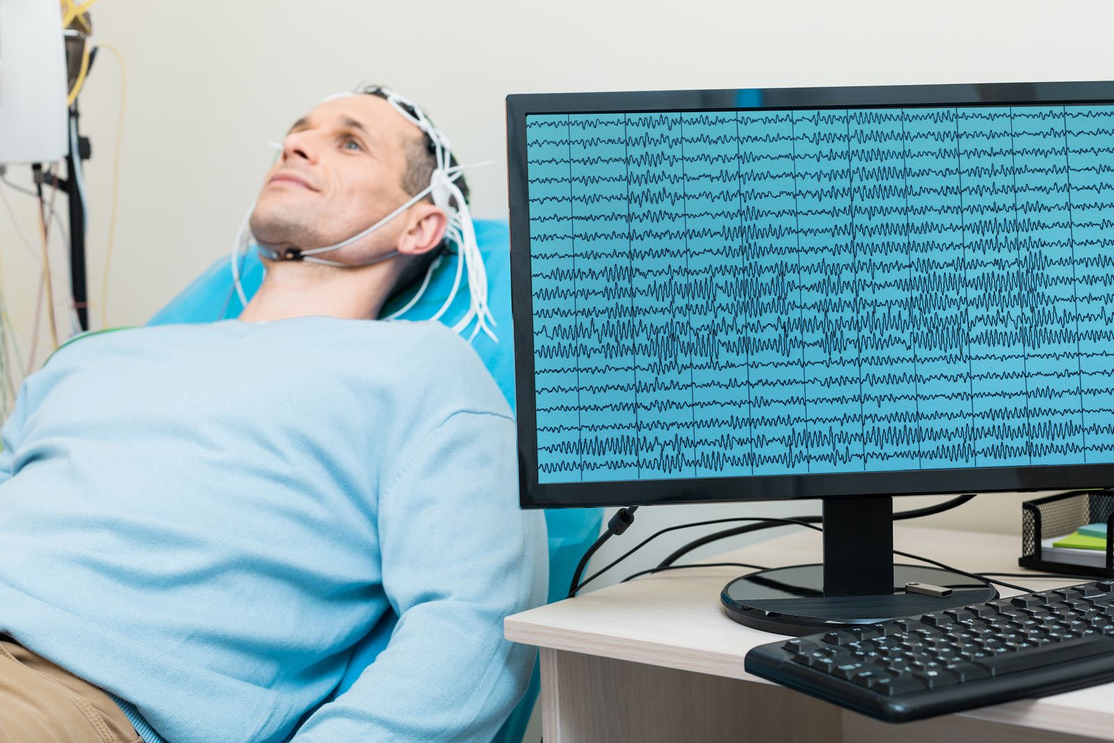 prueba-diagnostica-de-potenciales-evocados
